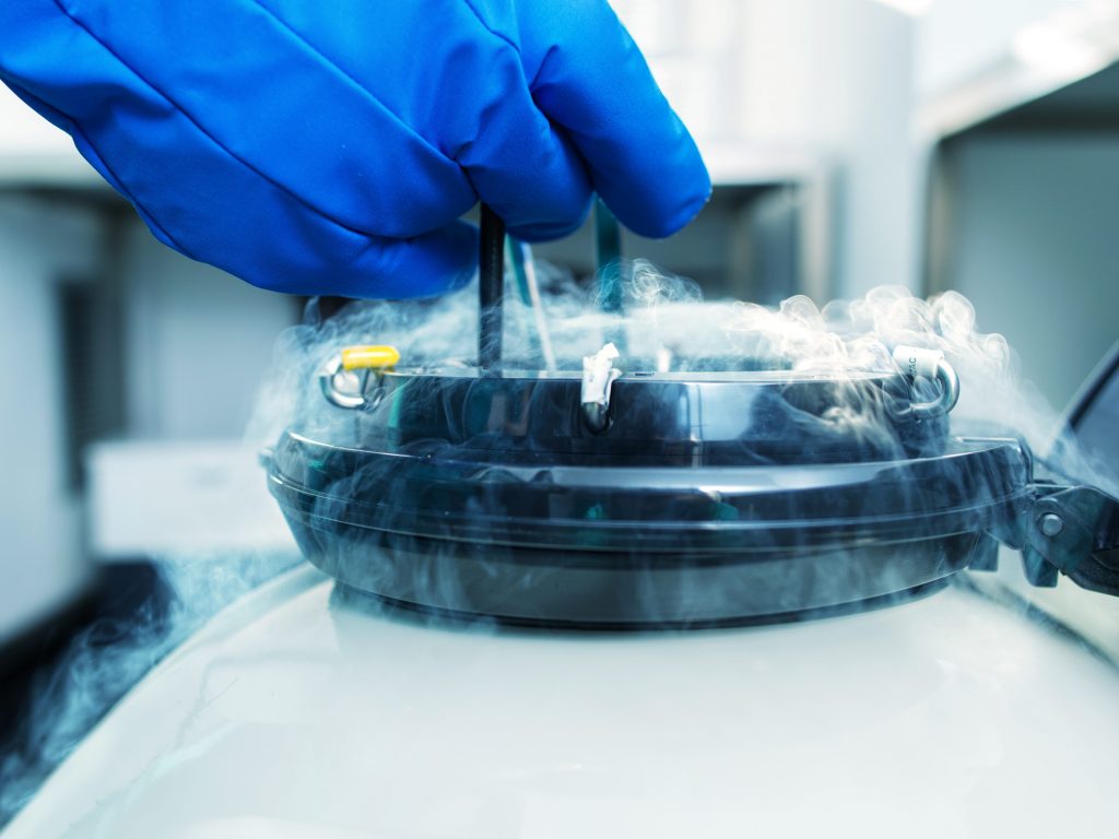 La conservazione del materiale seminale prevede l’esposizione dei campioni a bassissime temperature