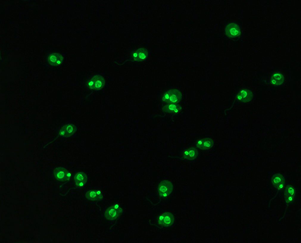 Crithidia bombi
